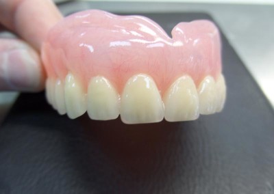 Ολικές Οδοντοστοιχίες με Genios P
