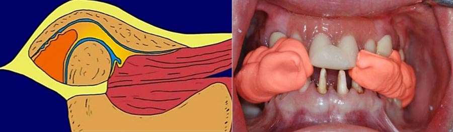 master_sigklisis_2016_02