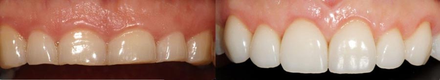 master_sigklisis_2016_03