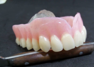 Οδοντοστοιχία Άνω Γνάθου με Διαφανή Υπερώα